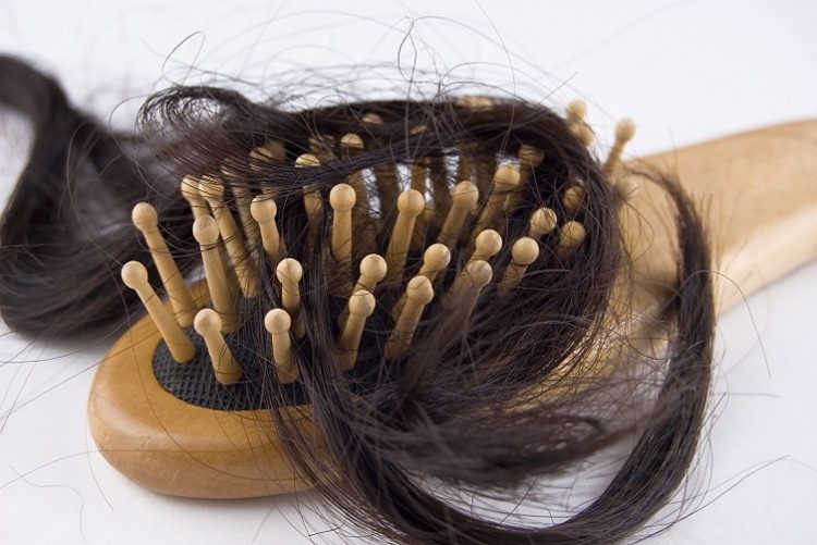 Female Hair Loss