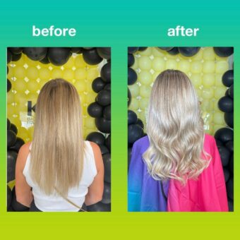 K18 treatment post
