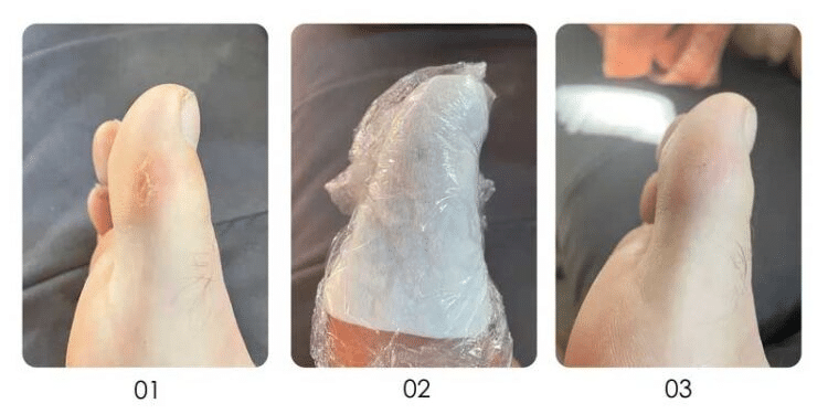 Burst use on Toe