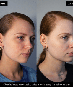 4779227446MASKOLOGYListingImages 14