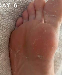 +maskology FOOT PEEL Professional Foot Treatment 1